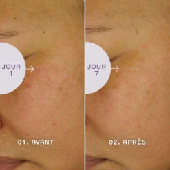 Ren Sérum Bio Jeunesse – Retinoid 30ml 11 Ren Sérum Bio Jeunesse – Retinoid 30ml -Dermalogica Soldes Boutique bio retinoid serum jeunesse 3292886 4 1140x1140