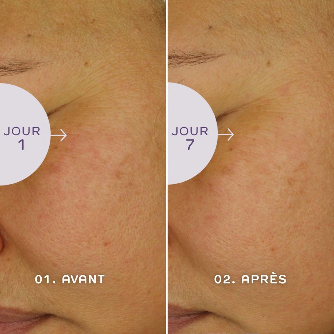 Ren Sérum Bio Jeunesse – Retinoid 30ml 6 Ren Sérum Bio Jeunesse – Retinoid 30ml – Image 4